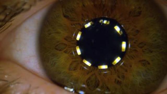 Macro Pupil Constricting in Slow Motion