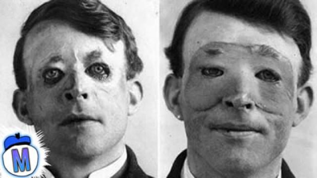 9 Craziest Things Doctors Have Ever Done