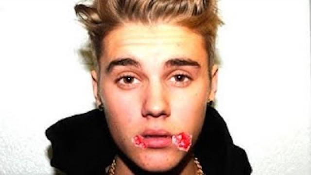 JUSTIN BIEBER and HERPES! (Bomb Dot Com)