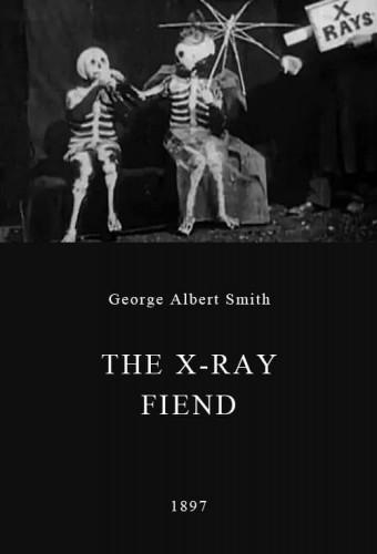 The X-Ray Fiend