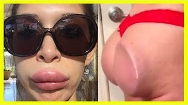 WORST PLASTIC SURGERY *FAILS*!