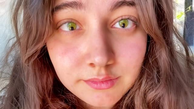 The Smallest Pupils in the World