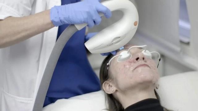 Bye-bye Lumps!