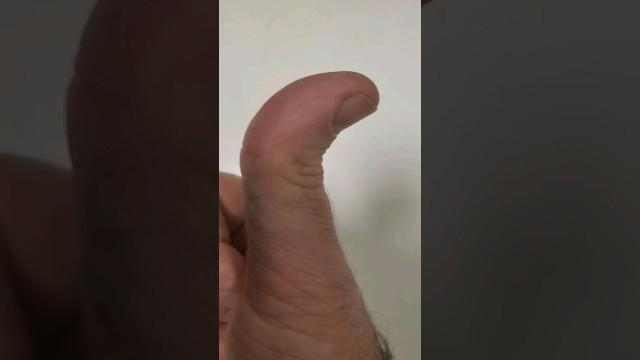 Can Your Thumb Do This?