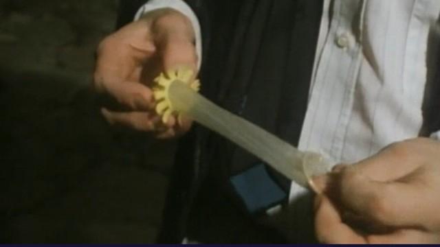 Le nœud du problème