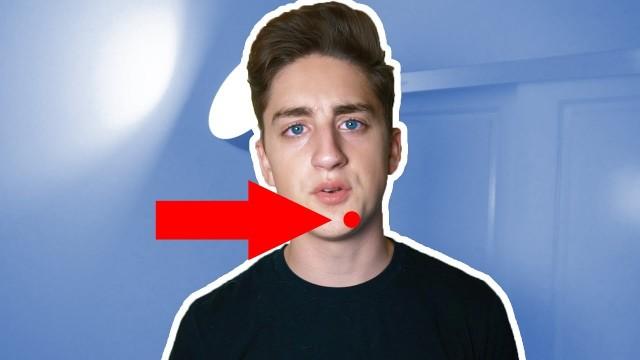 LEAVE MY PIMPLE ALONE